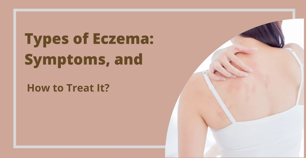 A woman touches a red, itchy rash on her shoulder and back. Text asks "Types of Eczema: Symptoms, and How to Treat It?".