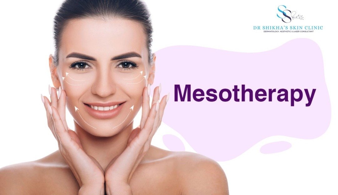 A woman smiles with hands near her face, overlaid with lines indicating treatment areas. Text reads "Mesotherapy". The logo and name of Dr Shikha's Skin Clinic are also included.