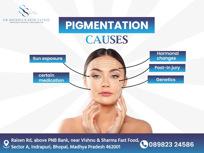 A diagram showing a woman's face connected by lines to text boxes listing causes of pigmentation: Sun exposure, certain medication, Hormonal changes, Post-injury, and Genetics. Text at the top reads "PIGMENTATION CAUSES". The logo and name of Dr Shikha's Skin Clinic, Bhopal address, and phone number are also included.