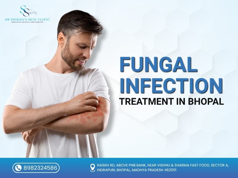 Man with red skin rash on arm showing symptoms of fungal infection, promoting fungal infection treatment in Bhopal at Dr. Shikha’s Skin Clinic.