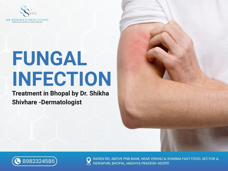 Man scratching red rash on his forearm, representing fungal skin infection, highlighting treatment services by Dr. Shikha Shivhare in Bhopal.