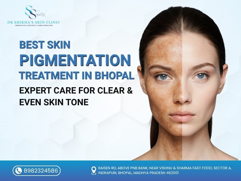 Best Skin Pigmentation Treatment in Bhopal by Dr. Shikha Shivhare for clear, healthy, and even-toned skin